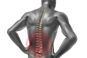 Cara Alami Menyembuhkan Radang Sumsum Tulang Belakang